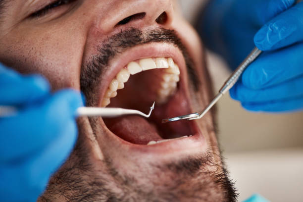 Best Emergency Dental Care for Sports Injuries in Mccaysville, GA